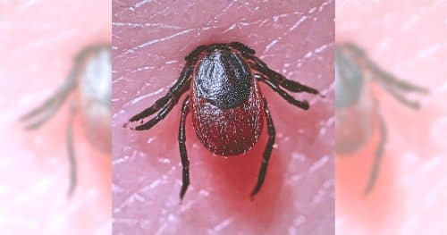 Tiny Bite, Big Stakes: Huntington Hospital Experts Urge Tick Checks as Lyme and Other Tick-Borne Illnesses Rise