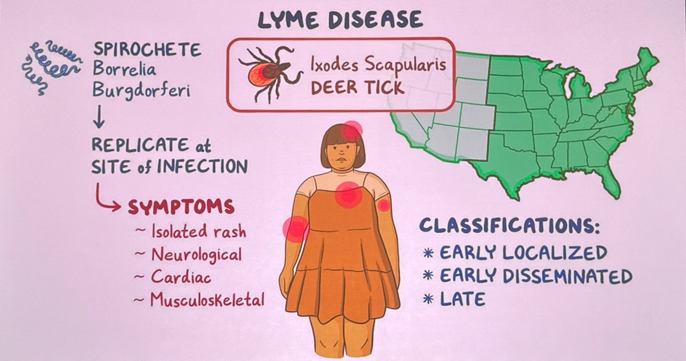 Tiny Bite, Big Stakes: Huntington Hospital Experts Urge Tick Checks as Lyme and Other Tick-Borne Illnesses Rise
