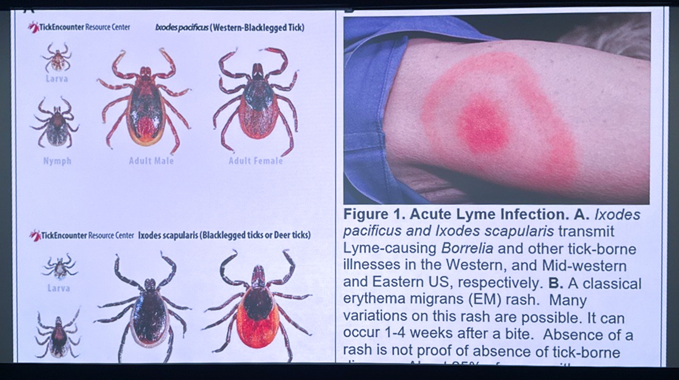 Tiny Bite, Big Stakes: Huntington Hospital Experts Urge Tick Checks as Lyme and Other Tick-Borne Illnesses Rise